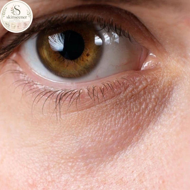 Benefits of Essential Oils For Dark Circles