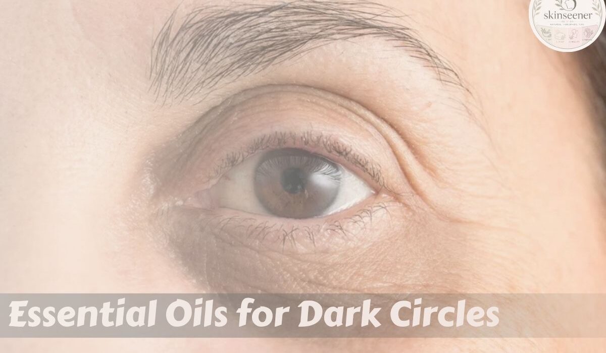 Essential Oils for Dark Circles