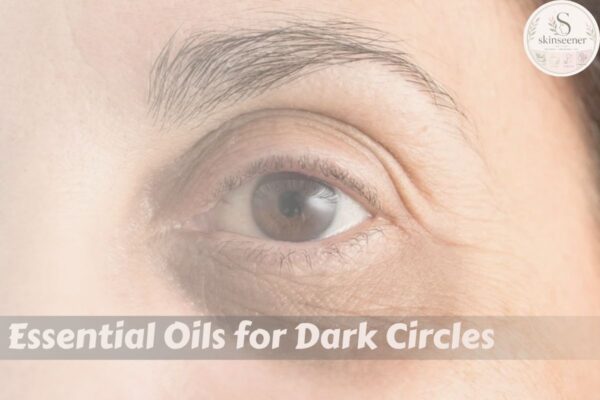 Essential Oils for Dark Circles