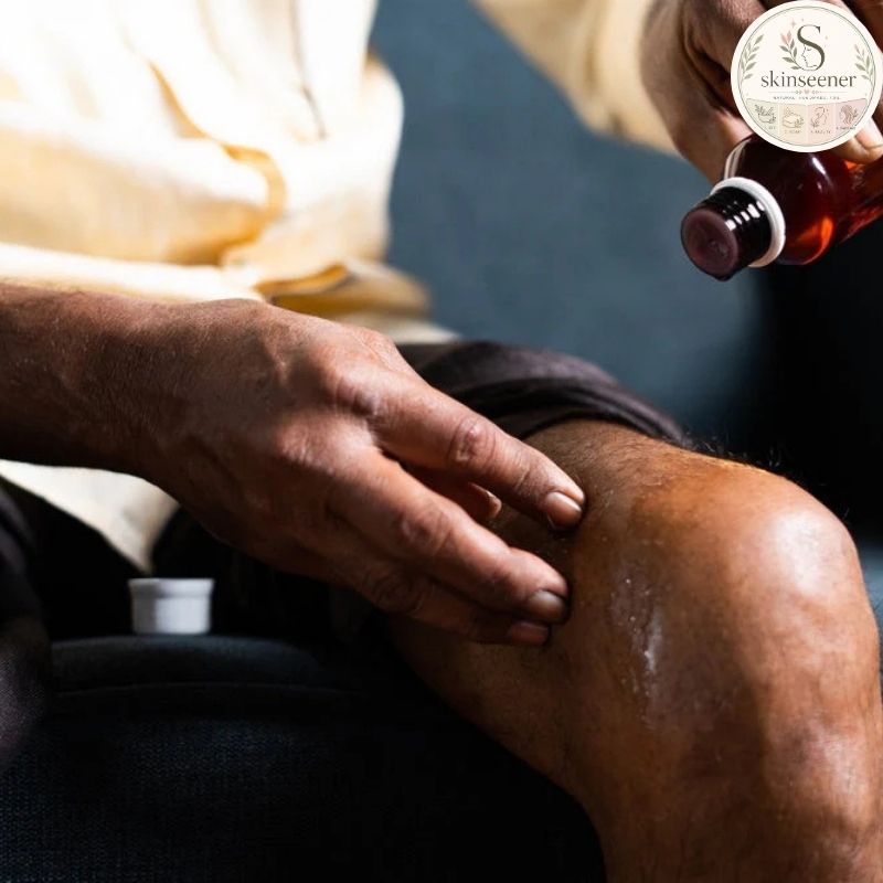 Best Oil for Knee Joint Pain
